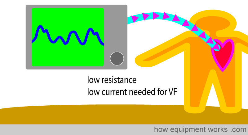 cvp_low_res
