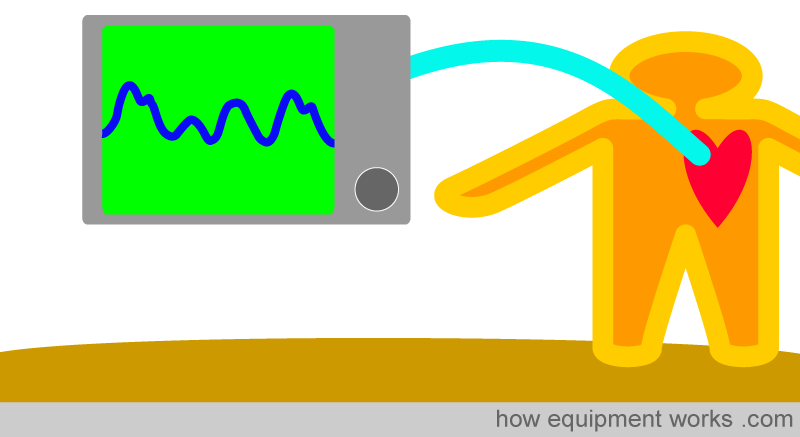 cvp_monitor