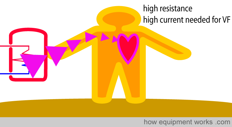 macro_hi_resistance