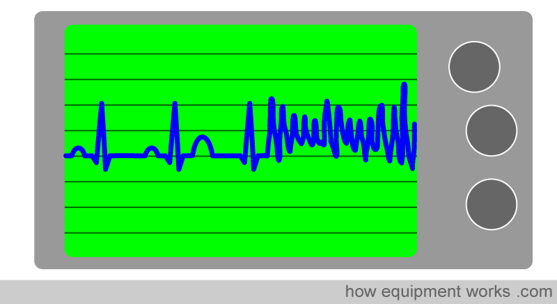 monitor_vf